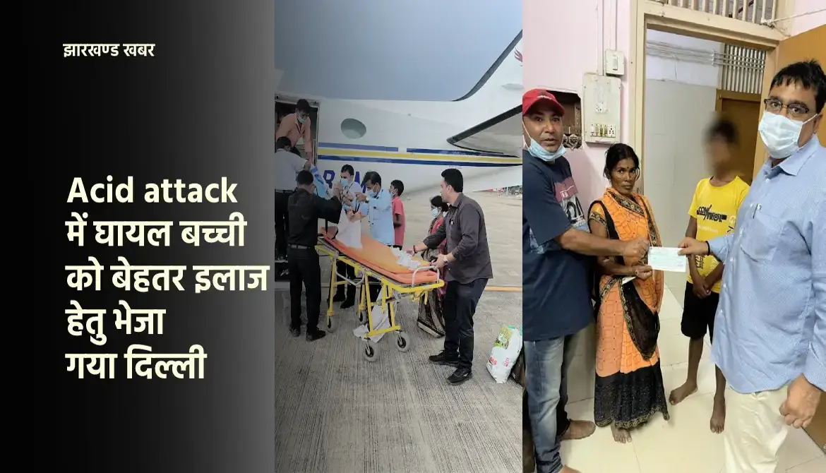 Acid attack : झारखण्ड में घायल बच्ची को बेहतर इलाज हेतु भेजा गया दिल्ली